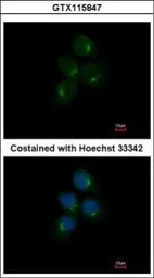 Anti-CHIA antibody used in Immunocytochemistry/ Immunofluorescence (ICC/IF). GTX115847