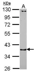 Anti-alpha 3 Catenin antibody [N1N3] used in Western Blot (WB). GTX115881