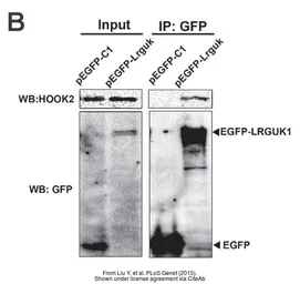 Anti-HOOK2 antibody used in Western Blot (WB). GTX115898
