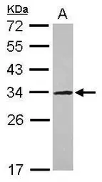 Anti-UTP11L antibody [N1C3] used in Western Blot (WB). GTX115929