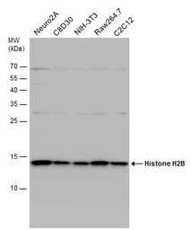 Anti-Histone H2B antibody used in Western Blot (WB). GTX115955