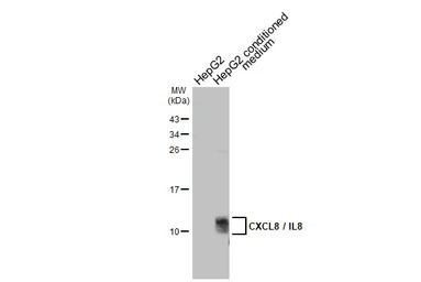 Anti-CXCL8 / IL8 antibody used in Western Blot (WB). GTX115959