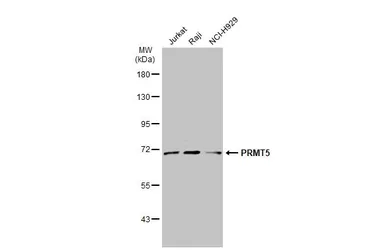Anti-PRMT5 antibody [N1C1] used in Western Blot (WB). GTX116004