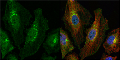 Anti-MAP4K4 antibody used in Immunocytochemistry/ Immunofluorescence (ICC/IF). GTX116008