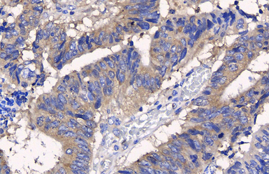 Anti-APC antibody [C3], C-term used in IHC (Paraffin sections) (IHC-P). GTX116009