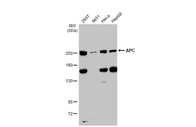 Anti-APC antibody [C3], C-term used in Western Blot (WB). GTX116009