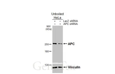 Anti-APC antibody [C3], C-term used in Western Blot (WB). GTX116009