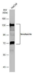 Anti-Involucrin antibody [N1N2], N-term used in Western Blot (WB). GTX116012