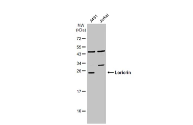 Anti-Loricrin antibody [N1], N-term used in Western Blot (WB). GTX116013