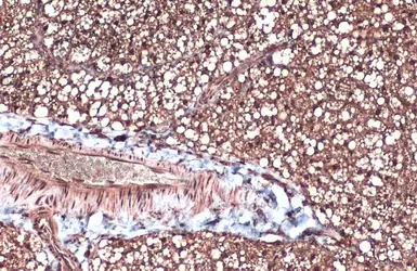 Anti-FABP4 antibody [N3C3] used in IHC (Paraffin sections) (IHC-P). GTX116036