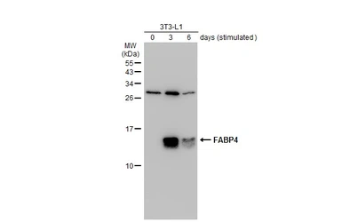 Anti-FABP4 antibody [N3C3] used in Western Blot (WB). GTX116036