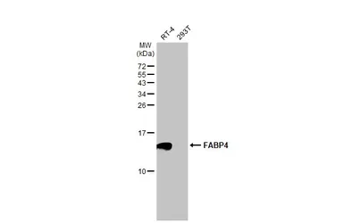 Anti-FABP4 antibody [N3C3] used in Western Blot (WB). GTX116036