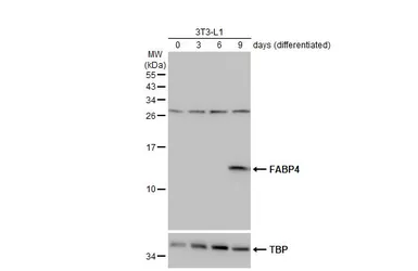 Anti-FABP4 antibody [N3C3] used in Western Blot (WB). GTX116036