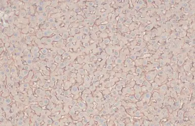 Anti-MRP1 antibody [N1N2], N-term used in IHC (Paraffin sections) (IHC-P). GTX116046