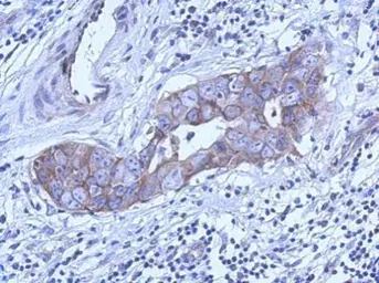 Anti-LC3B antibody [N1C3] used in IHC (Paraffin sections) (IHC-P). GTX116080
