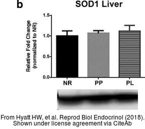 Anti-SOD2 antibody used in Western Blot (WB). GTX116093