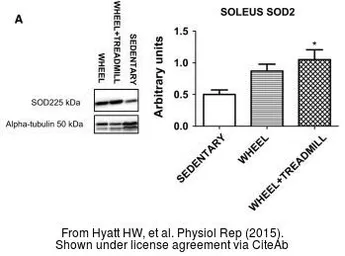 Anti-SOD2 antibody used in Western Blot (WB). GTX116093