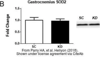 Anti-SOD2 antibody used in Western Blot (WB). GTX116093