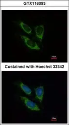 Anti-SOD2 antibody used in Immunocytochemistry/ Immunofluorescence (ICC/IF). GTX116093