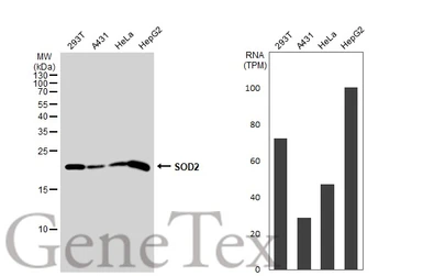 Anti-SOD2 antibody used in Western Blot (WB). GTX116093