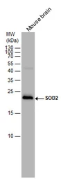 Anti-SOD2 antibody used in Western Blot (WB). GTX116093