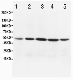 Anti-MTCO1 antibody used in Western Blot (WB). GTX11619