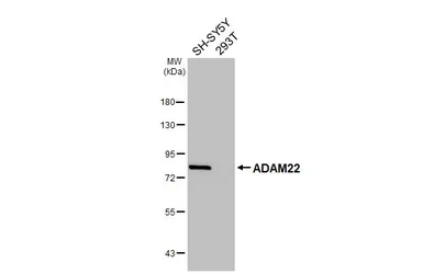Anti-ADAM22 antibody [N1N2], N-term used in Western Blot (WB). GTX116206