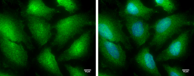 Anti-TRIM25 antibody used in Immunocytochemistry/ Immunofluorescence (ICC/IF). GTX116209