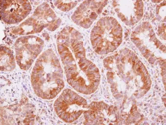 Anti-TRIM25 antibody used in IHC (Paraffin sections) (IHC-P). GTX116209