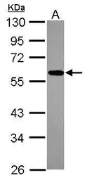 Anti-ZNF207 antibody [N3C3] used in Western Blot (WB). GTX116214