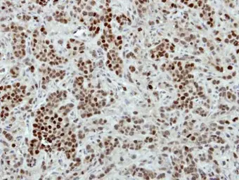 Anti-Macro H2A.2 antibody [N3C3] used in IHC (Paraffin sections) (IHC-P). GTX116234