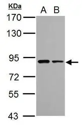 Anti-VPS35 antibody used in Western Blot (WB). GTX116260