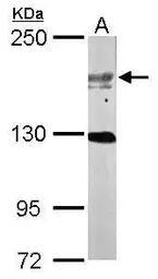 Anti-USP47 antibody [C3], C-term used in Western Blot (WB). GTX116278