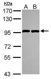Anti-ANKZF1 antibody [N1N3] used in Western Blot (WB). GTX116288