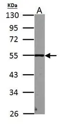 Anti-PHF10 antibody used in Western Blot (WB). GTX116314