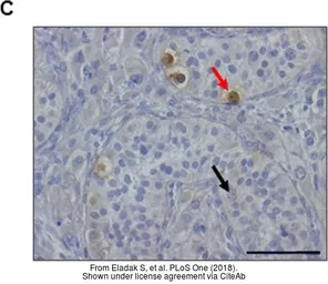 Anti-MAGEA4 antibody used in IHC (Paraffin sections) (IHC-P). GTX116357