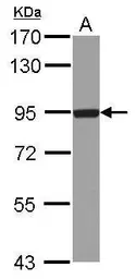 Anti-DTX3L antibody [N1N2], N-term used in Western Blot (WB). GTX116369