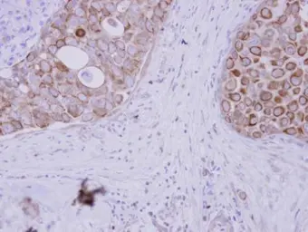 Anti-WDSUB1 antibody used in IHC (Paraffin sections) (IHC-P). GTX116382