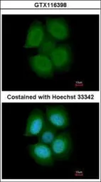 Anti-NXF3 antibody [C1C3] used in Immunocytochemistry/ Immunofluorescence (ICC/IF). GTX116398
