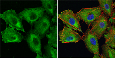 Anti-Galectin 1 antibody used in Immunocytochemistry/ Immunofluorescence (ICC/IF). GTX116411