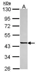 Anti-SGCE antibody [N1C1] used in Western Blot (WB). GTX116453