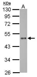 Anti-ZNF71 antibody used in Western Blot (WB). GTX116553