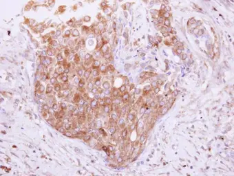 Anti-Tollip antibody [N2C3] used in IHC (Paraffin sections) (IHC-P). GTX116566