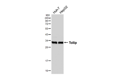 Anti-Tollip antibody [N2C3] used in Western Blot (WB). GTX116566