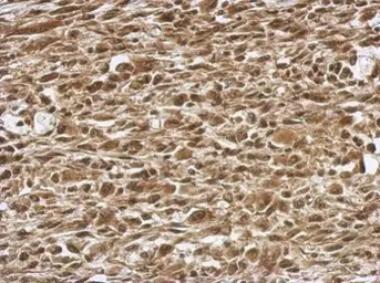 Anti-PRMT7 antibody used in IHC (Paraffin sections) (IHC-P). GTX116570