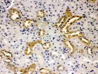 Anti-Presenilin 2 antibody used in IHC (Paraffin sections) (IHC-P). GTX11661