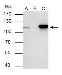 Anti-NUP107 antibody used in Immunoprecipitation (IP). GTX116664