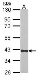 Anti-CREBZF antibody used in Western Blot (WB). GTX116707
