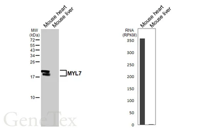 Anti-MYL7 antibody used in Western Blot (WB). GTX116713