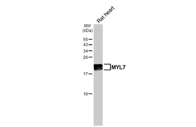 Anti-MYL7 antibody used in Western Blot (WB). GTX116713